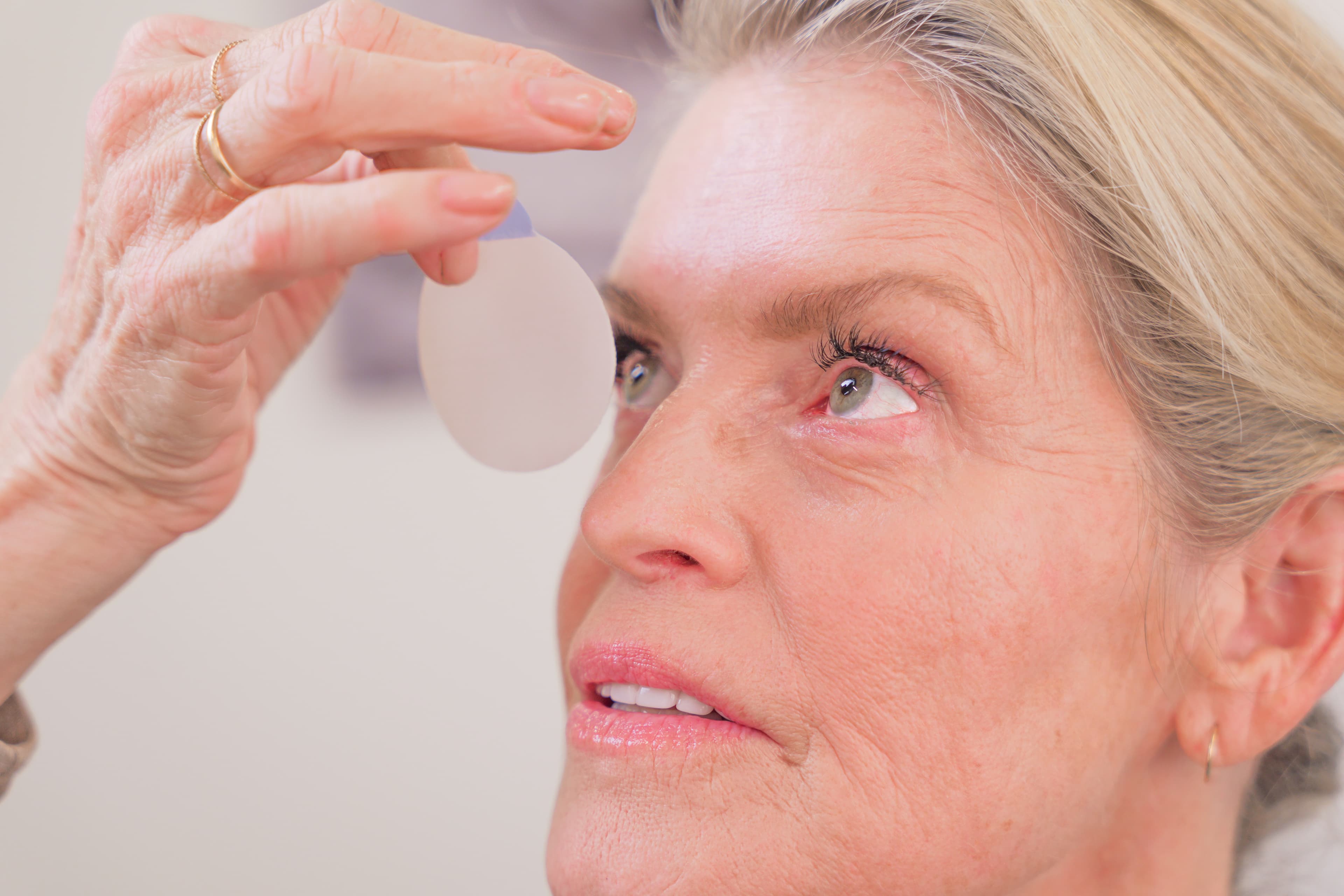 Lagophthalmos After Blepharoplasty: Why It Happens and What to Do